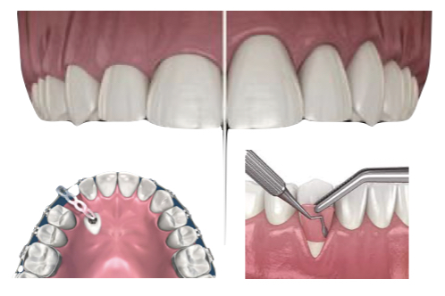 Dental implant continuing education MI